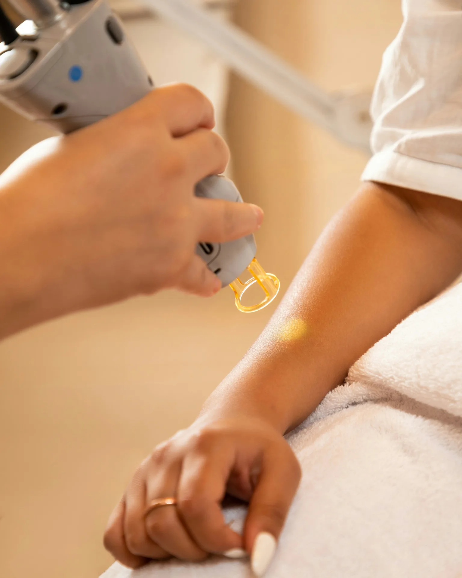Laser Treatments